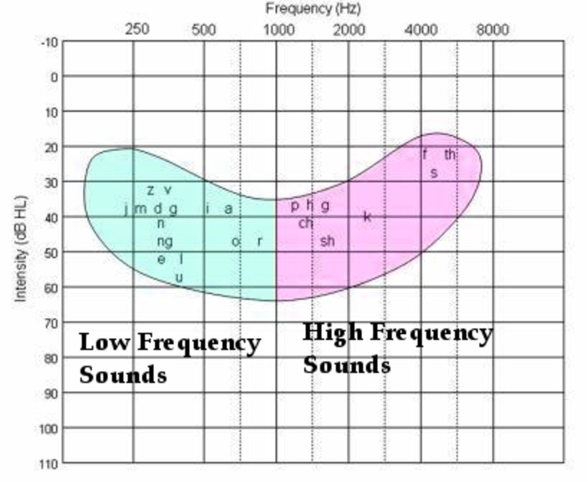 The Best Hearing Loss Simulations: Understanding ...