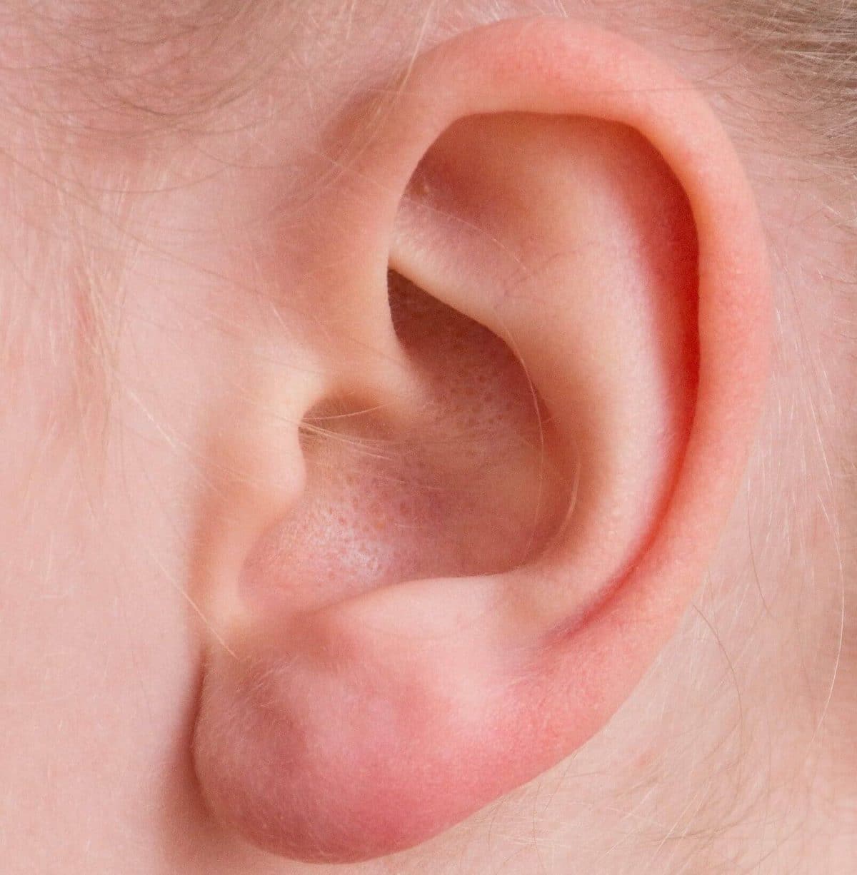 The Crux of Ear Wax Blockage