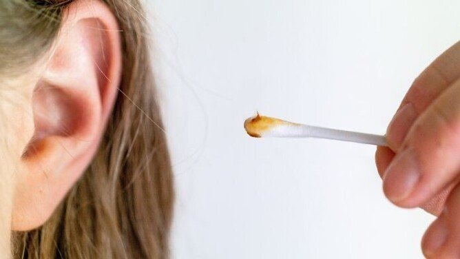 The Dos &  Donts of Ear Wax Removal