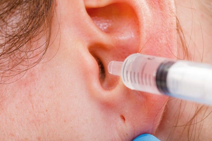 These TWO Ingredients Can Eliminate Earwax and Ear Infections in 2020 ...