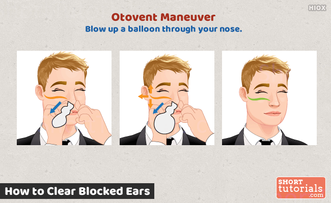 Unclog Ear Using Otovent Maneuver
