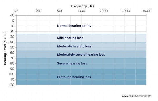 va hearing loss rating table