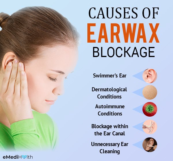 What Causes Earwax Buildup &  Ways to Remove It