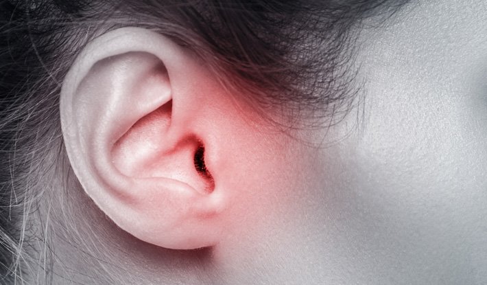 What Happens When Ear Infections Keep Coming Back?