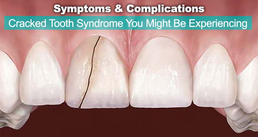 What Is Cracked Tooth Syndrome? Common Causes &  Complications