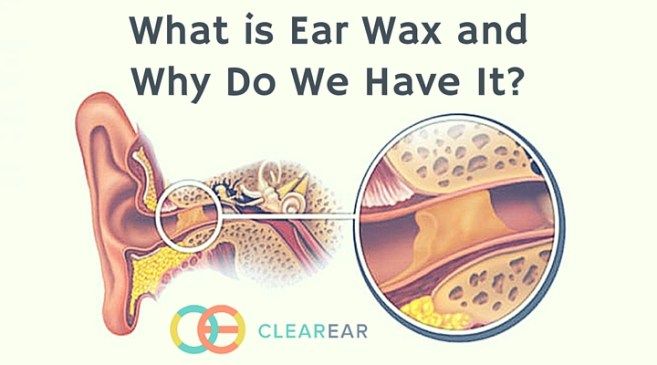 What is Ear Wax and Why Do We Have It?