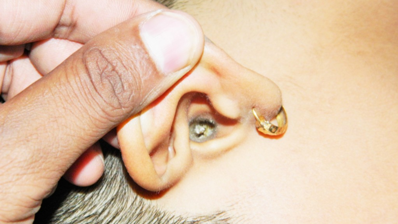 What is Earwax?