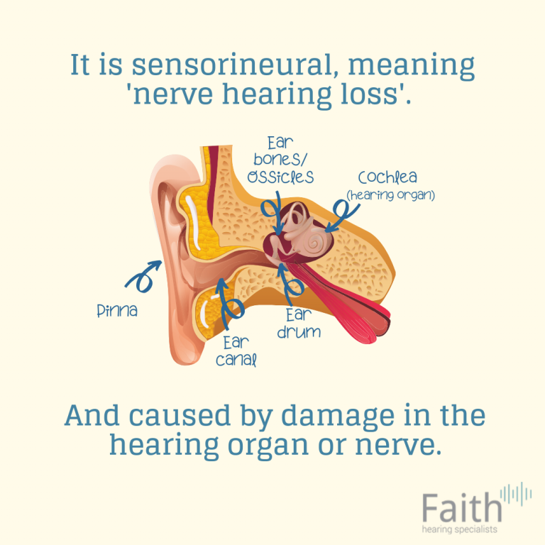 What Is Sudden Sensorineural Hearing Loss