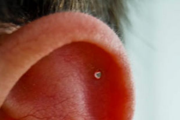 Why has my piercing got infected?