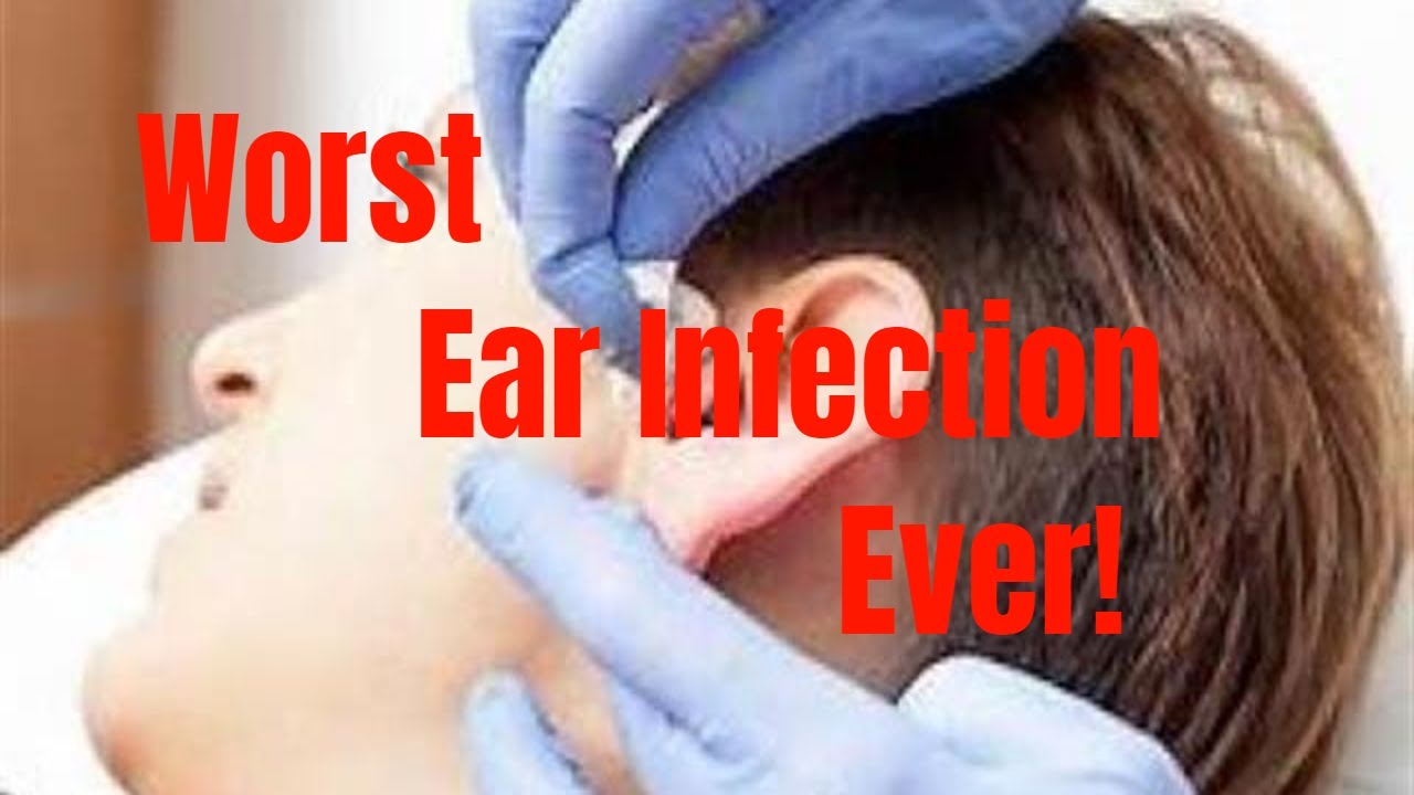 Worst Ear Infection Ever! Must See! Recommendations to ...